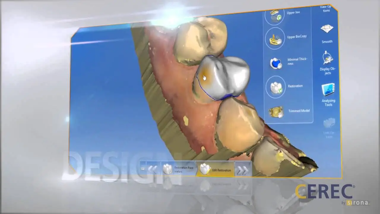 CEREC Crown Demo Video Thumbnail